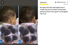 Kid's Hair Growth Scalp Stimulator